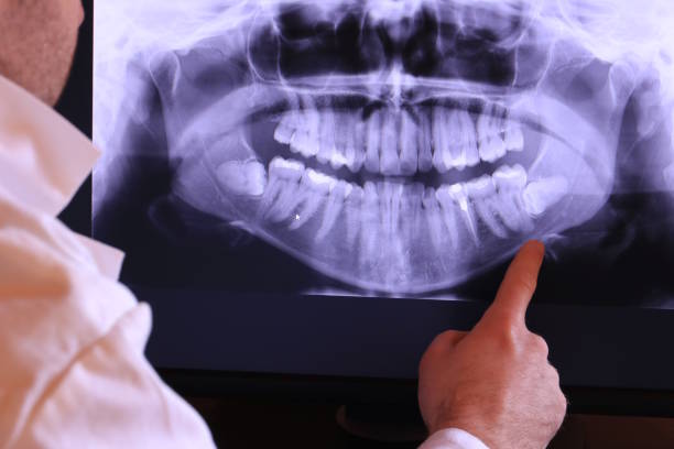 Best Broken Tooth Emergency  in Highpoint, OH